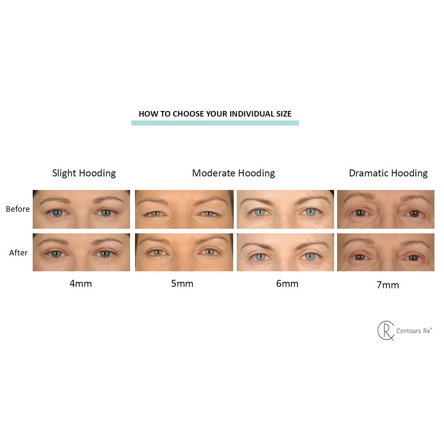 (ShopHQ) Contours Rx LIDS BY DESIGN Eyelid Correcting Strips Choice of ...