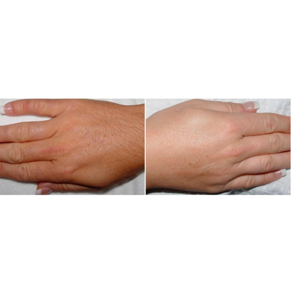 B&A Hand